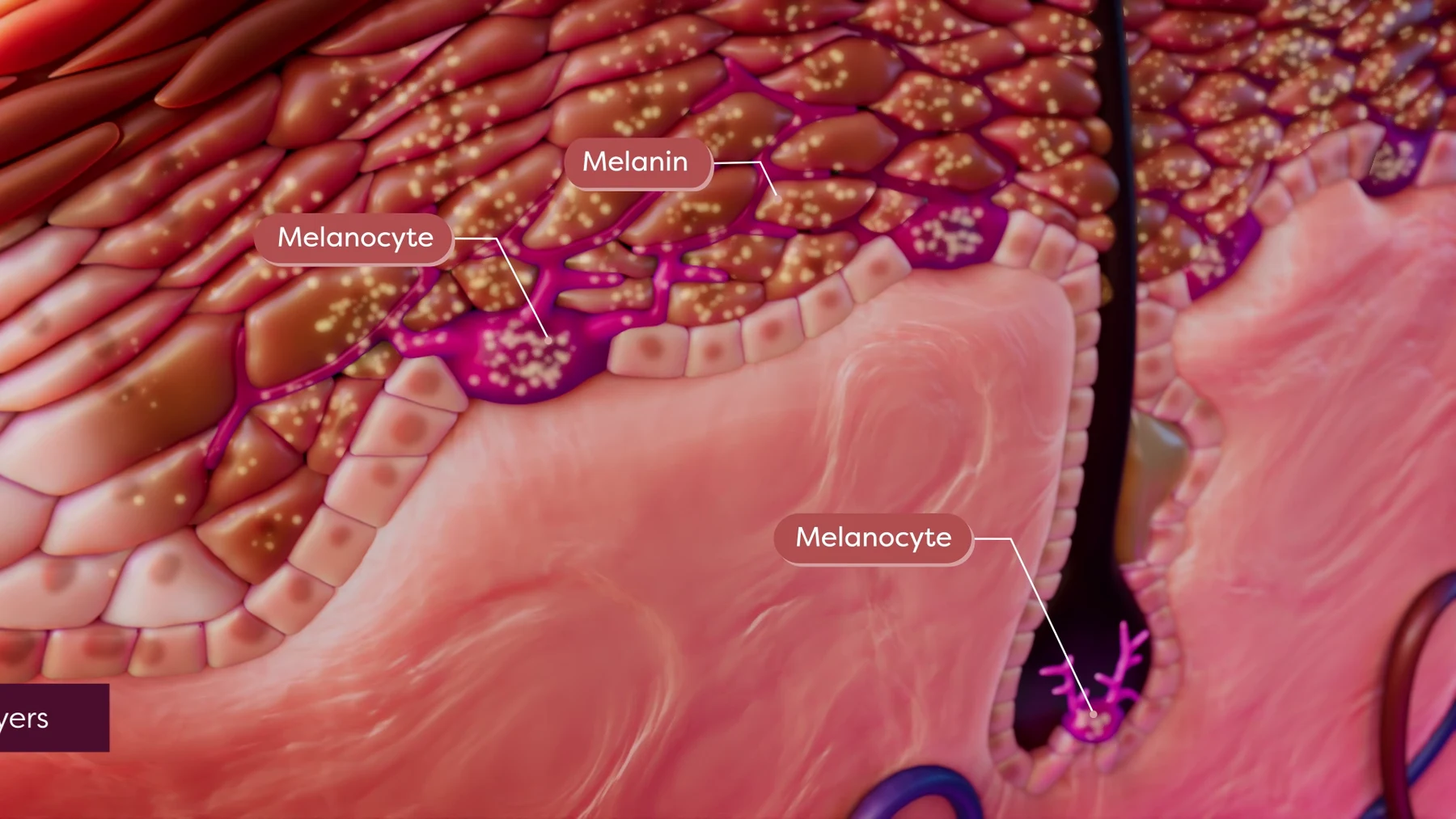 A cross-section of skin showing a hair follicle, melanocytes and melanin